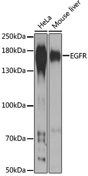 Anti-EGFR Antibody (CAB11352)