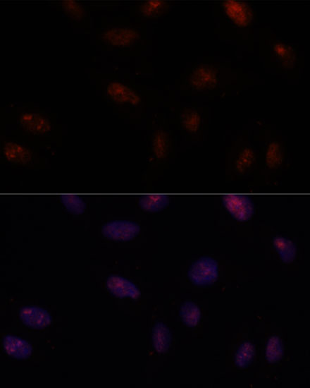 Anti-SF3B1 Antibody (CAB15801)