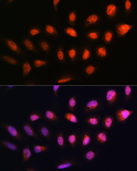 Anti-NPLOC4 Antibody (CAB3256)