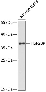 Anti-HSF2BP Antibody