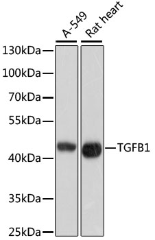 Anti-TGFB1 Antibody (CAB2124)