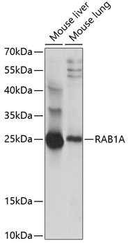 Anti-RAB1A Antibody (CAB14663)