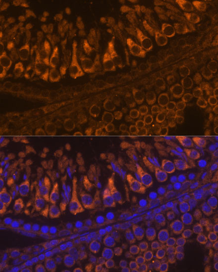 Anti-ELSPBP1 Antibody (CAB15882)