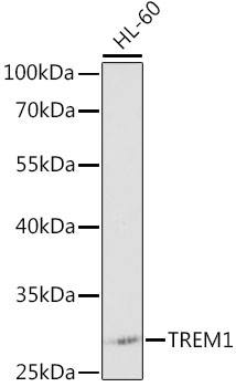 Anti-TREM1 Antibody (CAB0292)