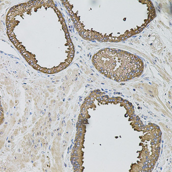 Anti-Caspase-12 Antibody (CAB0217)