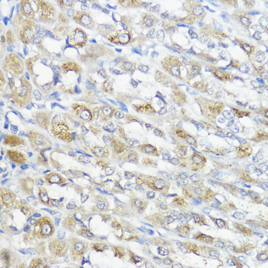 Anti-GPX2 Antibody (CAB15999)