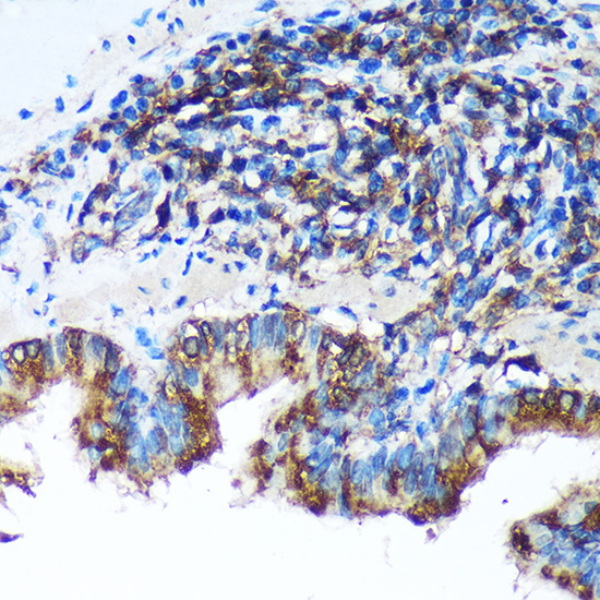 Anti-FBXO21 Antibody (CAB16107)