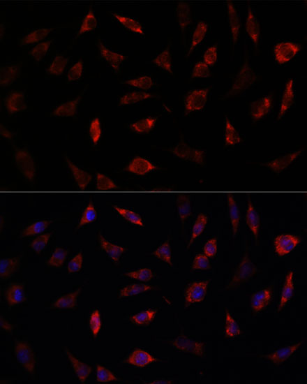 Anti-FXN / Frataxin Antibody (CAB1745)