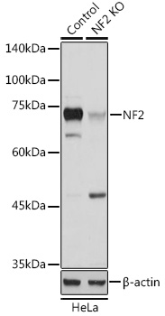 Anti-NF2 Antibody [KO Validated] (CAB13626)