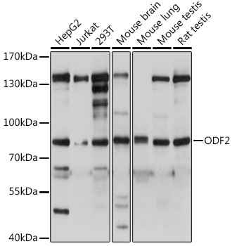 Anti-ODF2 Antibody (CAB15630)