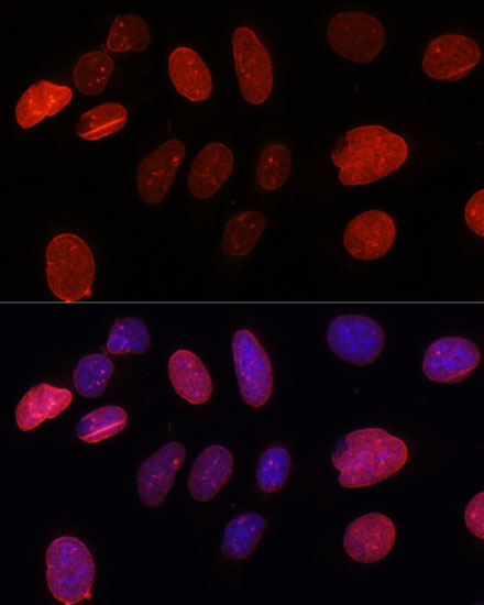 Anti-SUN2 Antibody (CAB16325)