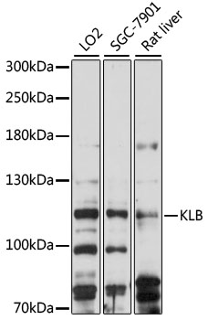 Anti-KLB Antibody (CAB15629)