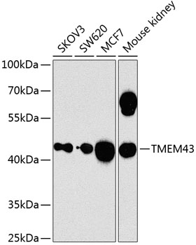 Anti-TMEM43 Polyclonal Antibody (CAB8509)