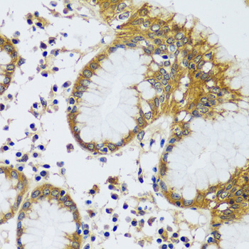 Anti-CAMLG Antibody (CAB13720)