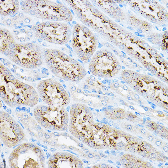 Anti-p70 S6 kinase Antibody (CAB16968)