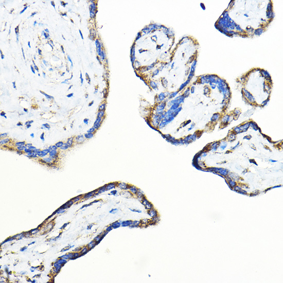 Anti-LNPEP Antibody (CAB11959)