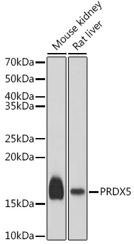 Anti-PRDX5 Antibody (CAB6329)