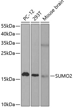 Anti-SUMO2 Antibody (CAB2571)