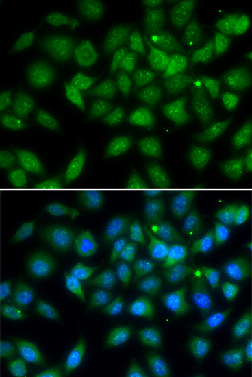 Anti-LELP1 Antibody (CAB7148)