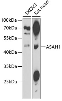 Anti-ASAH1 Antibody (CAB13948)