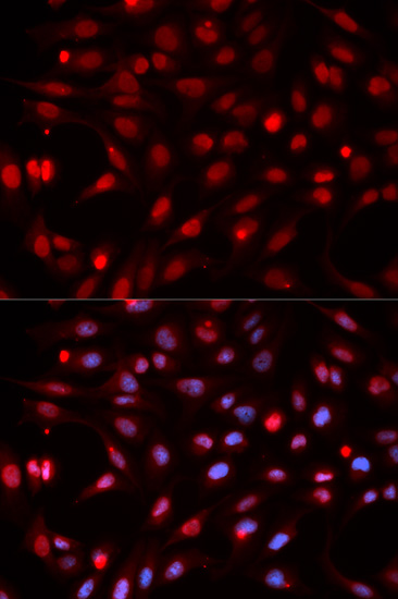 Anti-APEX1 Antibody [KO Validated] (CAB2587)