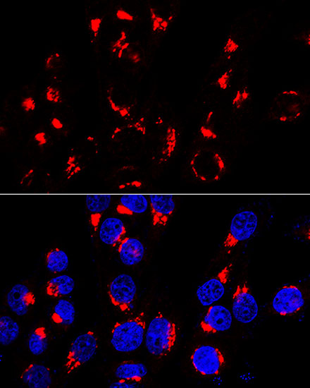 Anti-GOLM1 Antibody (CAB7283)