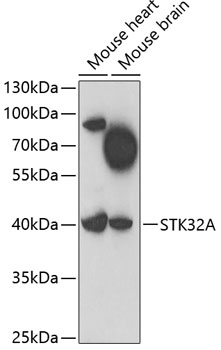 Anti-STK32A Antibody (CAB7613)