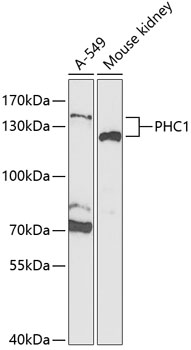 Anti-PHC1 Antibody (CAB5843)
