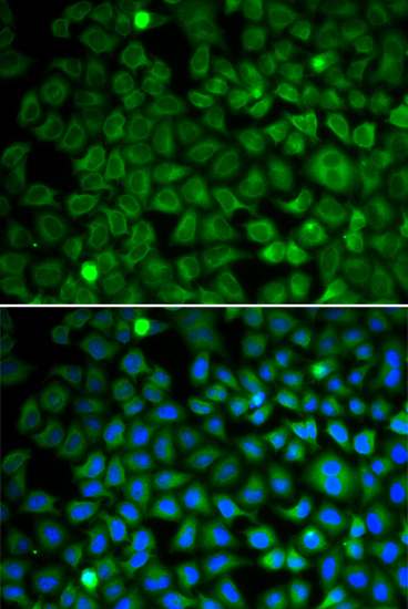 Anti-NUP62 Antibody (CAB2499)