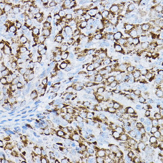 Anti-P2Y purinoceptor 14 Polyclonal Antibody (CAB8178)