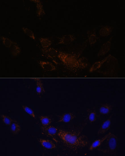 Anti-PSMB7 Antibody (CAB14771)