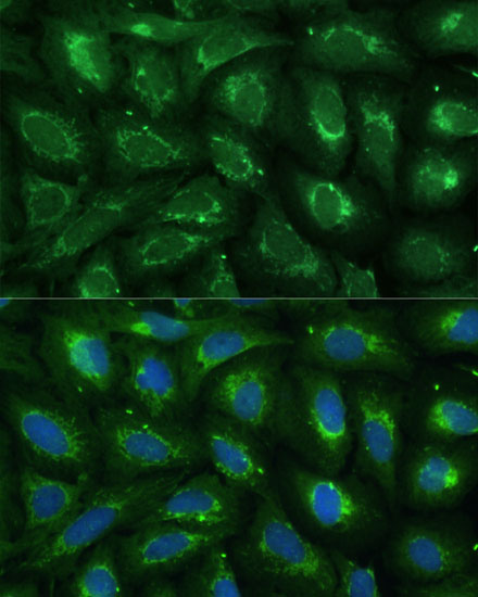 Anti-ABCD2 Antibody (CAB16033)