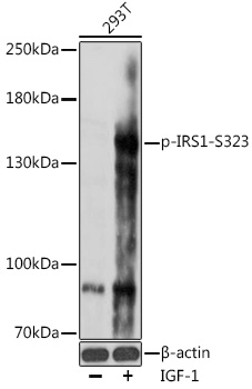 Anti-Phospho-IRS1-S323 Antibody (CABP0966)