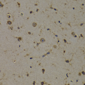 Anti-EEF1D Antibody (CAB2509)