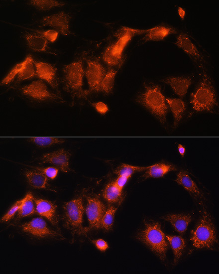 Anti-GCSH Antibody (CAB13695)