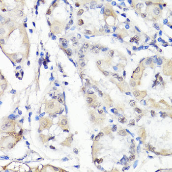 Anti-TBX20 Antibody (CAB15994)