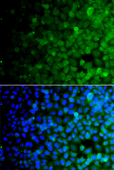 Anti-USP10 Antibody (CAB7505)