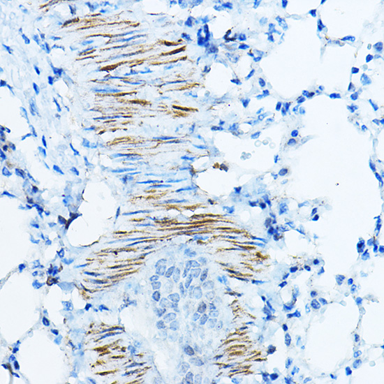 Anti-DES Antibody (CAB0699)