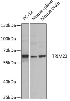 Anti-TRIM23 Polyclonal Antibody (CAB8329)