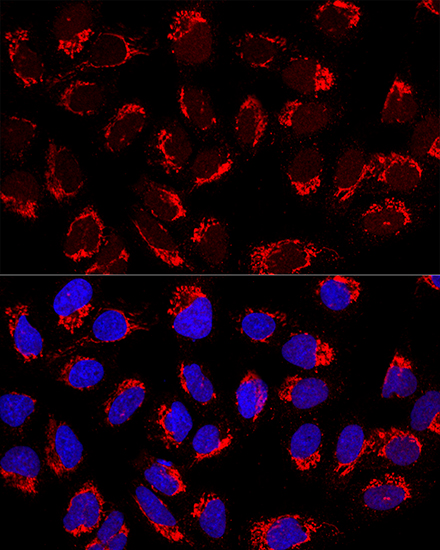 Anti-AP1M2 Polyclonal Antibody (CAB8331)