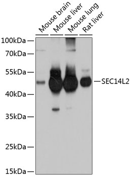 Anti-SEC14L2 Antibody (CAB10586)