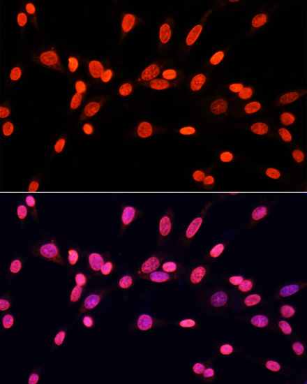 Anti-DiMethyl-DNMT3A-K44 Antibody (CAB16012)