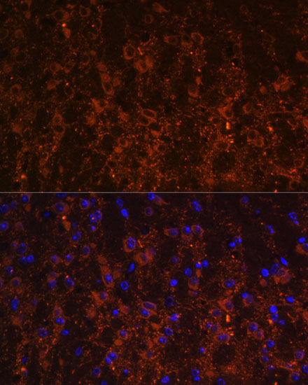 Anti-SNX13 Antibody (CAB12821)