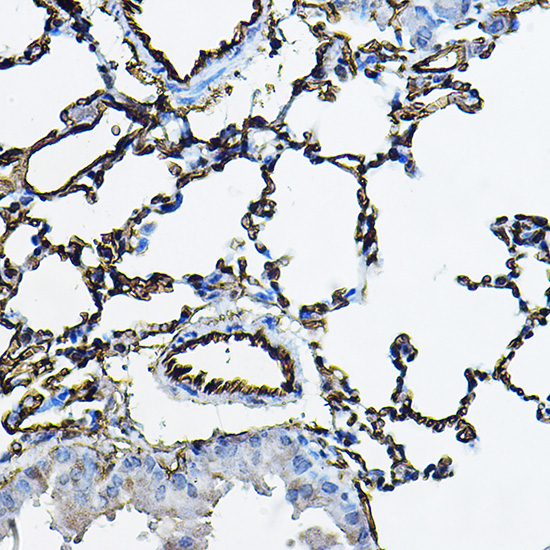 Anti-ACE Antibody (CAB2805)