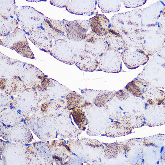 Anti-UCP3 Antibody (CAB16995)