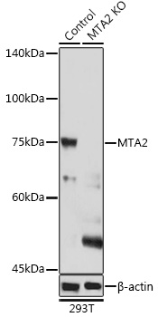 Anti-MTA2 Antibody [KO Validated] (CAB2243)
