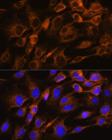 Anti-Aquaporin-8 Polyclonal Antibody (CAB8539)