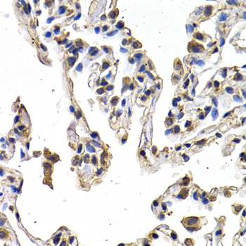 Anti-FIGF Antibody (CAB1194)