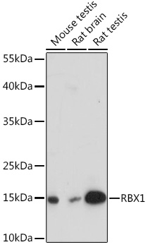 Anti-RBX1 Antibody (CAB14500)