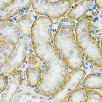 Anti-ARFGAP1 Antibody (CAB7118)